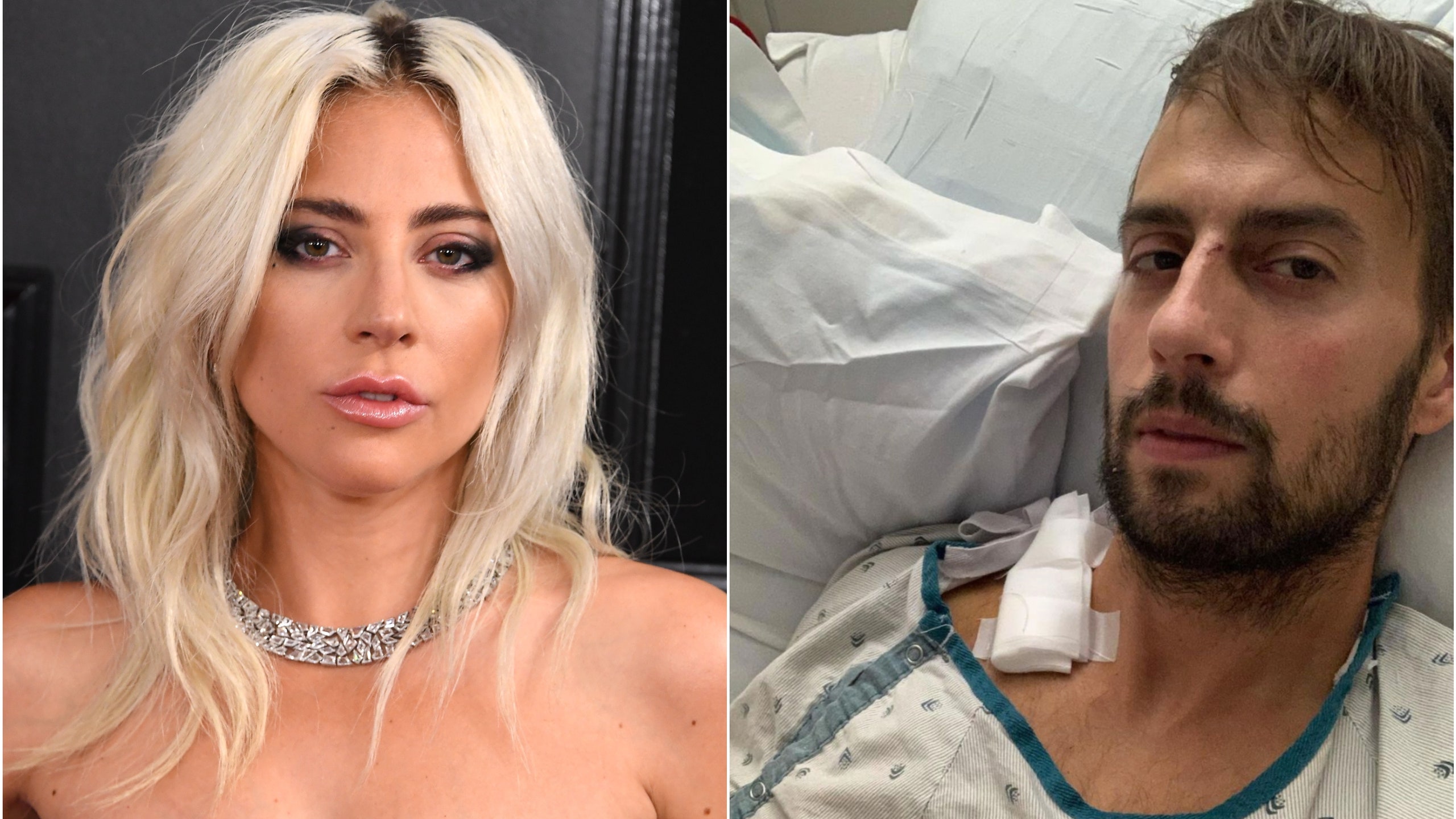https://www.glamour.com/story/lady-gaga-dog-walker-ryan-fischer-breaks-his-silence-after-being-shot