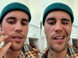 https://www.am.com.mx/espectaculos/A-Justin-Bieber-se-le-paraliza-el-rostro-a-causa-del-sindrome-Ramsay-Hunt-VIDEO-20220610-0086.html