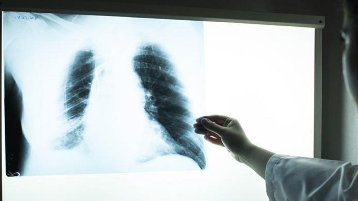despues-de-20-anos-tuberculosis-vuelve-a-propagarse-en-todo-el-mundo-oms